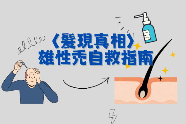 〈髮現真相〉  雄性禿自救指南